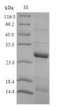 Recombinant Rat Thyroxine 5-deiodinase (Dio3), partial (170:U→missing) – Figure 1 of 1