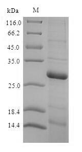 Recombinant Rat Thyroxine 5-deiodinase (Dio3), partial (170:U→missing) – Figure 1 of 1