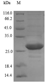 (Tris-Glycine gel) Discontinuous SDS-PAGE (reduced) with 5% enrichment gel and 15% separation gel.