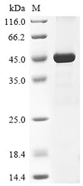 (Tris-Glycine gel) Discontinuous SDS-PAGE (reduced) with 5% enrichment gel and 15% separation gel.