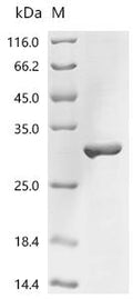(Tris-Glycine gel) Discontinuous SDS-PAGE (reduced) with 5% enrichment gel and 15% separation gel.
