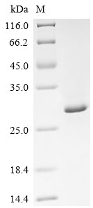 (Tris-Glycine gel) Discontinuous SDS-PAGE (reduced) with 5% enrichment gel and 15% separation gel.