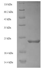 Recombinant Danio rerio Metallothionein-1 (mt) – Figure 1 of 1