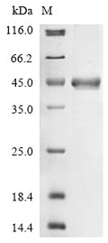 (Tris-Glycine gel) Discontinuous SDS-PAGE (reduced) with 5% enrichment gel and 15% separation gel.