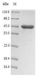 (Tris-Glycine gel) Discontinuous SDS-PAGE (reduced) with 5% enrichment gel and 15% separation gel.