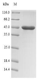 (Tris-Glycine gel) Discontinuous SDS-PAGE (reduced) with 5% enrichment gel and 15% separation gel.