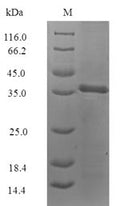 (Tris-Glycine gel) Discontinuous SDS-PAGE (reduced) with 5% enrichment gel and 15% separation gel.