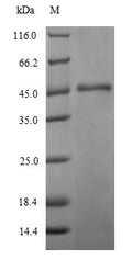 (Tris-Glycine gel) Discontinuous SDS-PAGE (reduced) with 5% enrichment gel and 15% separation gel.