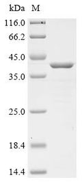 (Tris-Glycine gel) Discontinuous SDS-PAGE (reduced) with 5% enrichment gel and 15% separation gel.