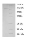 Recombinant Saccharomyces cerevisiae Cystathionine beta-lyase (STR3) – Figure 1 of 1