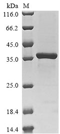(Tris-Glycine gel) Discontinuous SDS-PAGE (reduced) with 5% enrichment gel and 15% separation gel.