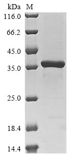 (Tris-Glycine gel) Discontinuous SDS-PAGE (reduced) with 5% enrichment gel and 15% separation gel.