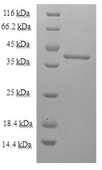 Recombinant Toxocara canis 26KDA secreted antigen (TES-26) – Figure 1 of 1