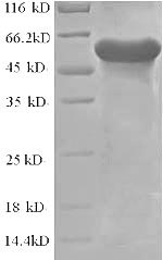 Recombinant Lactobacillus plantarum L-lactate dehydrogenase 1 (ldh1) – Figure 1 of 1