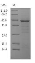 (Tris-Glycine gel) Discontinuous SDS-PAGE (reduced) with 5% enrichment gel and 15% separation gel.