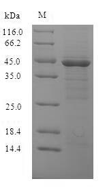 (Tris-Glycine gel) Discontinuous SDS-PAGE (reduced) with 5% enrichment gel and 15% separation gel.