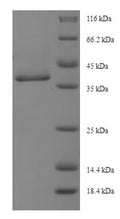 Recombinant Human MAP3K7 C-terminal-like protein (MAP3K7CL) – Figure 1 of 1