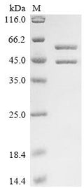 (Tris-Glycine gel) Discontinuous SDS-PAGE (reduced) with 5% enrichment gel and 15% separation gel.