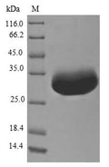 (Tris-Glycine gel) Discontinuous SDS-PAGE (reduced) with 5% enrichment gel and 15% separation gel.