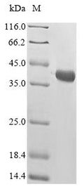 (Tris-Glycine gel) Discontinuous SDS-PAGE (reduced) with 5% enrichment gel and 15% separation gel.