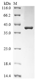 (Tris-Glycine gel) Discontinuous SDS-PAGE (reduced) with 5% enrichment gel and 15% separation gel.