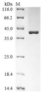 (Tris-Glycine gel) Discontinuous SDS-PAGE (reduced) with 5% enrichment gel and 15% separation gel.