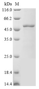 (Tris-Glycine gel) Discontinuous SDS-PAGE (reduced) with 5% enrichment gel and 15% separation gel.