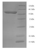 Recombinant Zaire ebolavirus Pre-small/secreted glycoprotein (GP) – Figure 1 of 1