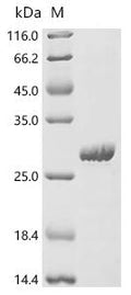 (Tris-Glycine gel) Discontinuous SDS-PAGE (reduced) with 5% enrichment gel and 15% separation gel.