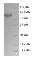 Recombinant Mycobacterium tuberculosis Steroid C26-monooxygenase (cyp125) – Figure 1 of 1