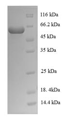 Recombinant Mycobacterium tuberculosis Steroid C26-monooxygenase (cyp125) – Figure 1 of 1