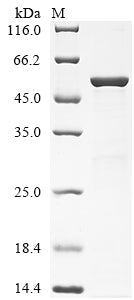 (Tris-Glycine gel) Discontinuous SDS-PAGE (reduced) with 5% enrichment gel and 15% separation gel.