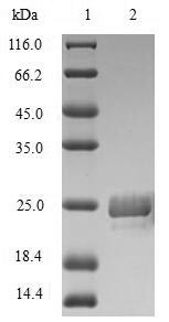 (Tris-Glycine gel) Discontinuous SDS-PAGE (reduced) with 5% enrichment gel and 15% separation gel.