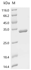 (Tris-Glycine gel) Discontinuous SDS-PAGE (reduced) with 5% enrichment gel and 15% separation gel.