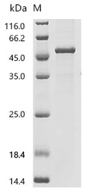 (Tris-Glycine gel) Discontinuous SDS-PAGE (reduced) with 5% enrichment gel and 15% separation gel.