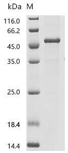 (Tris-Glycine gel) Discontinuous SDS-PAGE (reduced) with 5% enrichment gel and 15% separation gel.