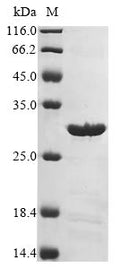 (Tris-Glycine gel) Discontinuous SDS-PAGE (reduced) with 5% enrichment gel and 15% separation gel.