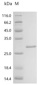 (Tris-Glycine gel) Discontinuous SDS-PAGE (reduced) with 5% enrichment gel and 15% separation gel.