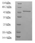 Recombinant Human Purine nucleoside phosphorylase (PNP) – Figure 1 of 1
