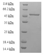 Recombinant Human Purine nucleoside phosphorylase (PNP) – Figure 1 of 1