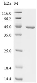 (Tris-Glycine gel) Discontinuous SDS-PAGE (reduced) with 5% enrichment gel and 15% separation gel.