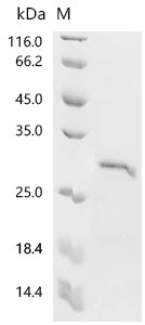 (Tris-Glycine gel) Discontinuous SDS-PAGE (reduced) with 5% enrichment gel and 15% separation gel.