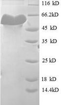 Recombinant Mouse H-2 class I histocompatibility antigen, K-D alpha chain (H2-K1), partial – Figure 1 of 1