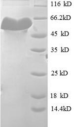 Recombinant Mouse H-2 class I histocompatibility antigen, K-D alpha chain (H2-K1), partial – Figure 1 of 1