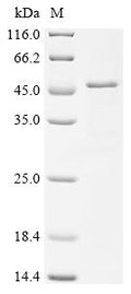 (Tris-Glycine gel) Discontinuous SDS-PAGE (reduced) with 5% enrichment gel and 15% separation gel.