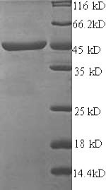 Recombinant JC polyomavirus Minor capsid protein VP2 – Figure 1 of 1