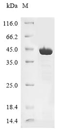 (Tris-Glycine gel) Discontinuous SDS-PAGE (reduced) with 5% enrichment gel and 15% separation gel.