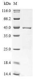 (Tris-Glycine gel) Discontinuous SDS-PAGE (reduced) with 5% enrichment gel and 15% separation gel.