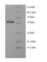 Recombinant Epstein-Barr virus Lytic switch protein BZLF1 (BZLF1) – Figure 1 of 1