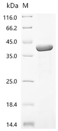 (Tris-Glycine gel) Discontinuous SDS-PAGE (reduced) with 5% enrichment gel and 15% separation gel.